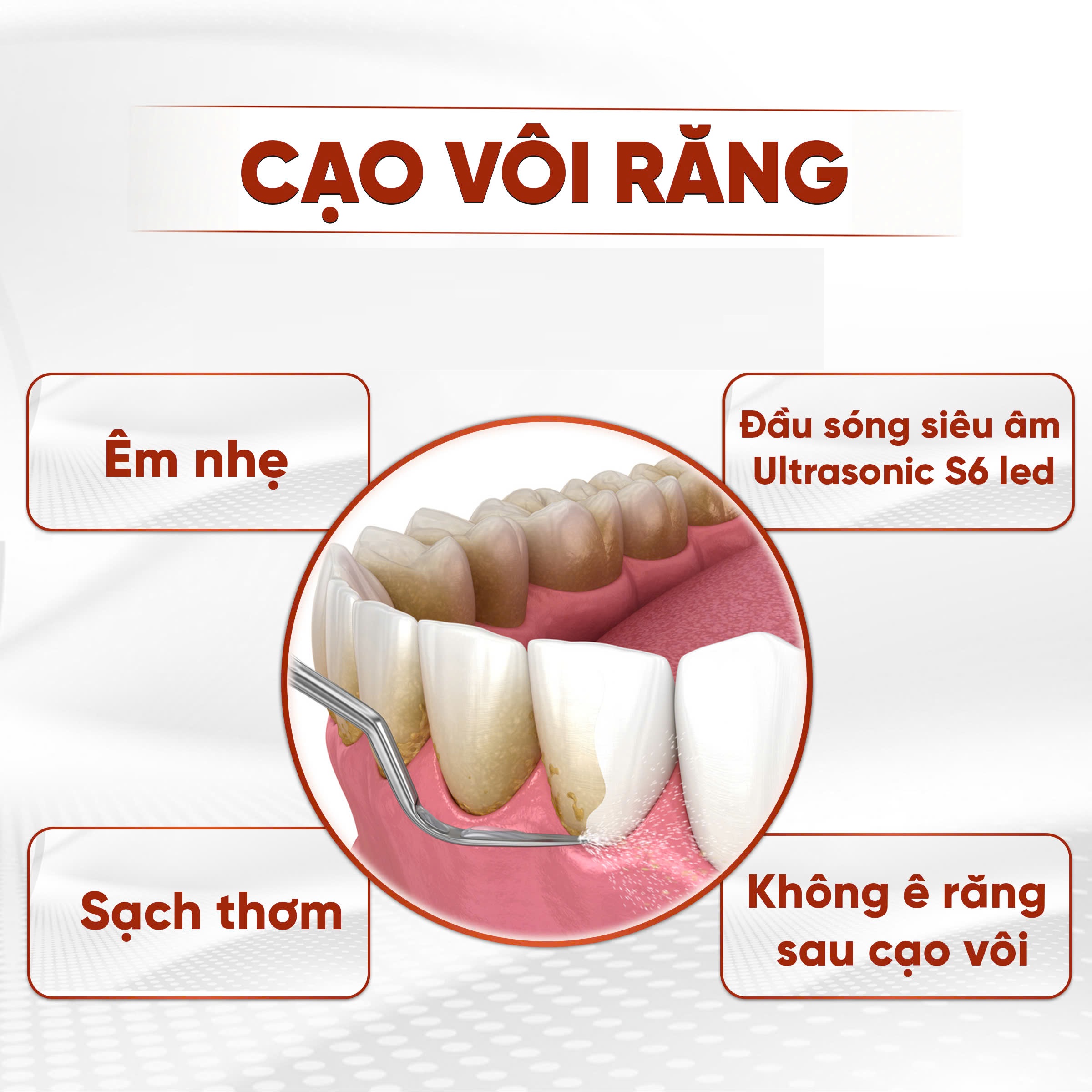 Cạo vôi răng nhẹ nhàng