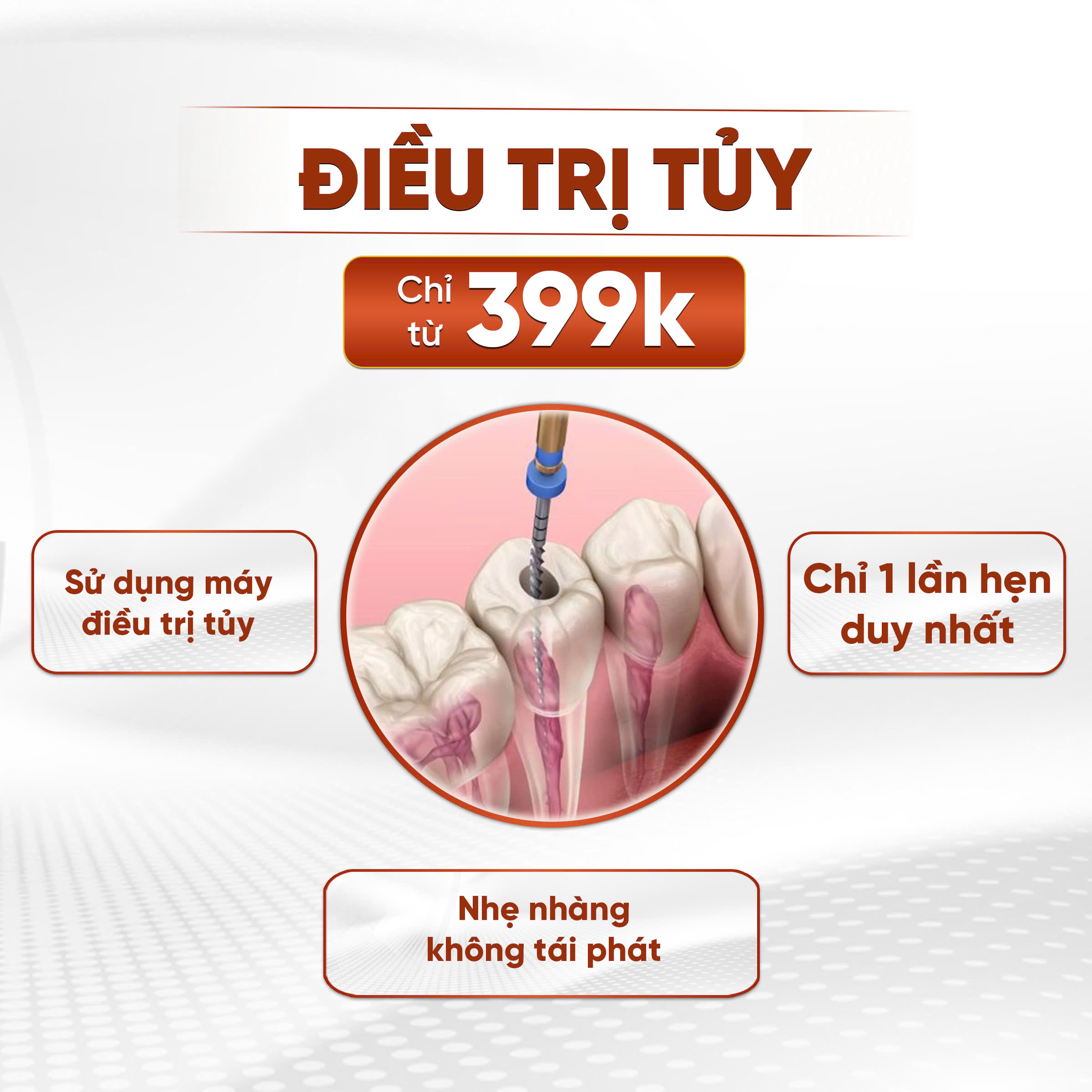 Điều trị tủy răng với 1 lần hẹn