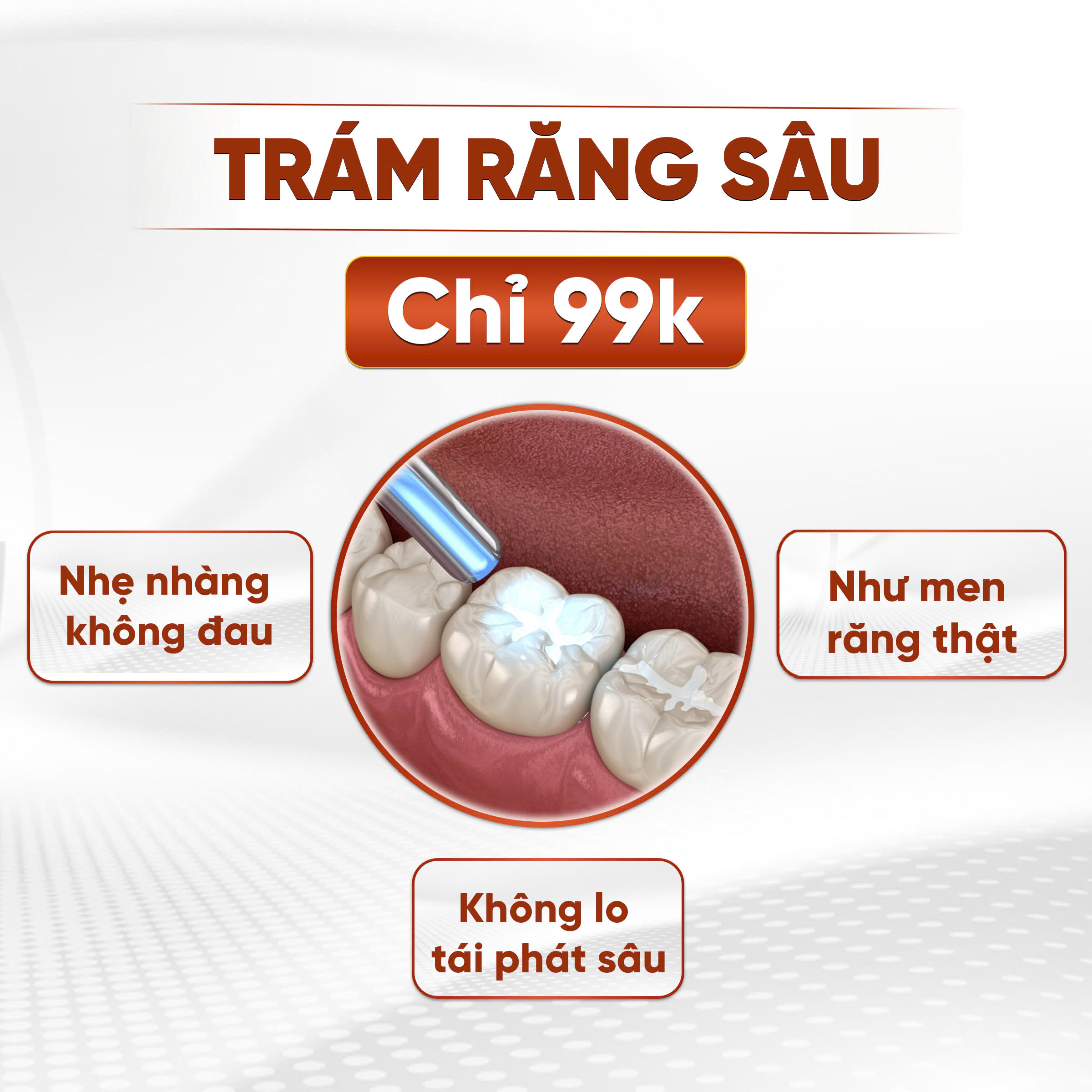 Trám răng sâu thẩm mỹ