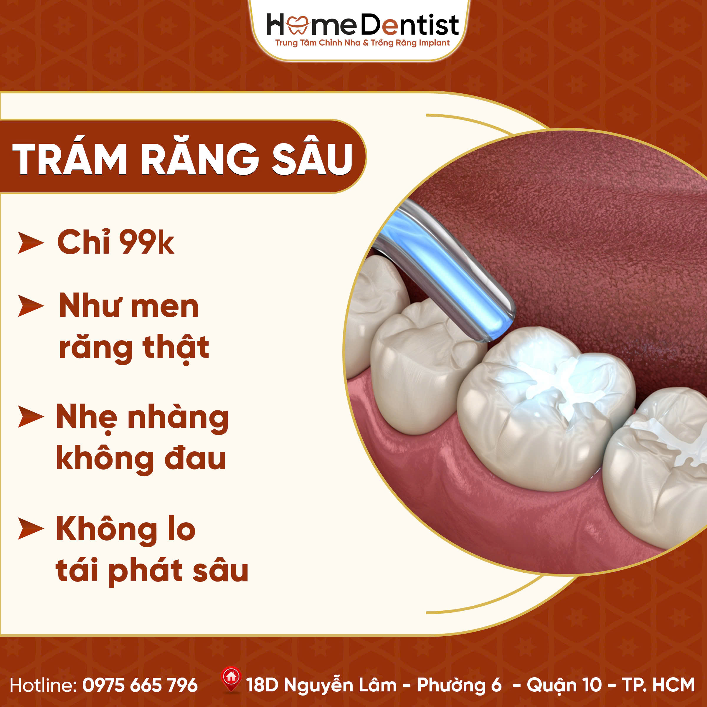 Ưu đãi trám răng sâu thẩm mỹ 99k