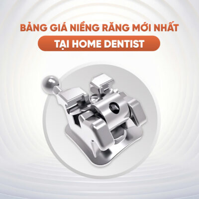 bảng giá niềng răng ưu đãi