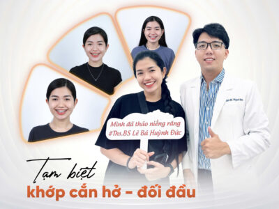 Niềng răng cùng bác sĩ Lê Bá huỳnh Đức